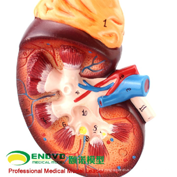 SELL 12434 Enlarge Model Kidney ,2 Part , Anatomy Urinary Models